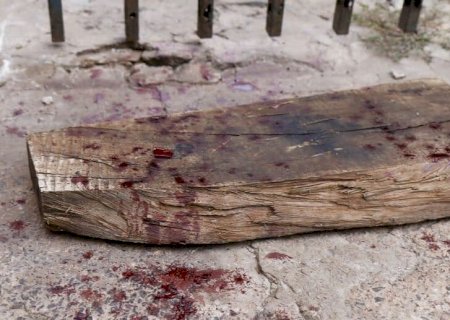 Agredido a pauladas e esfaqueado, rapaz é internado em estado grave