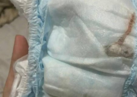 “Rato' encontrado em fralda de bebê era um pedaço de plástico