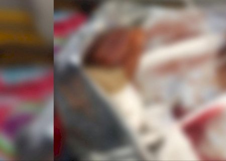 Idosa é socorrida em estado grave após ataque de pit bull