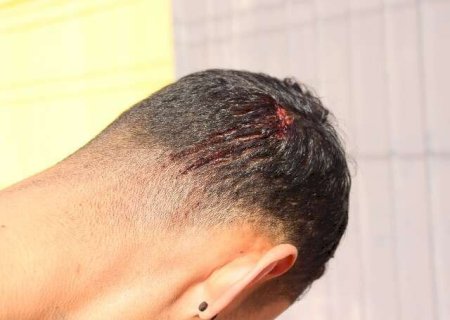 Jovem é agredido com coronhada em assalto e tem celular e bicicleta levados