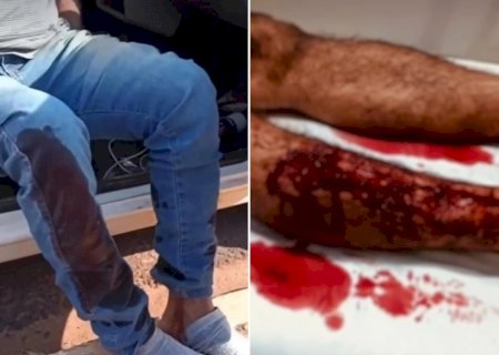 NOVA ANDRADINA: Homem é atacado por dois cães no Jardim Imperial